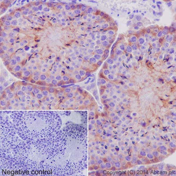 Immunohistochemistry (Formalin/PFA-fixed paraffin-embedded sections) - Anti-PKC antibody [EPR17368] (AB181558)