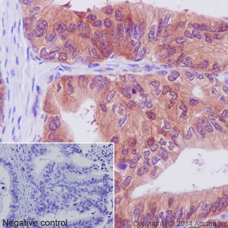 Immunohistochemistry (Formalin/PFA-fixed paraffin-embedded sections) - Anti-PKC antibody [EPR17368] (AB181558)