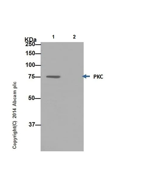 Immunoprecipitation - Anti-PKC antibody [EPR17368] (AB181558)
