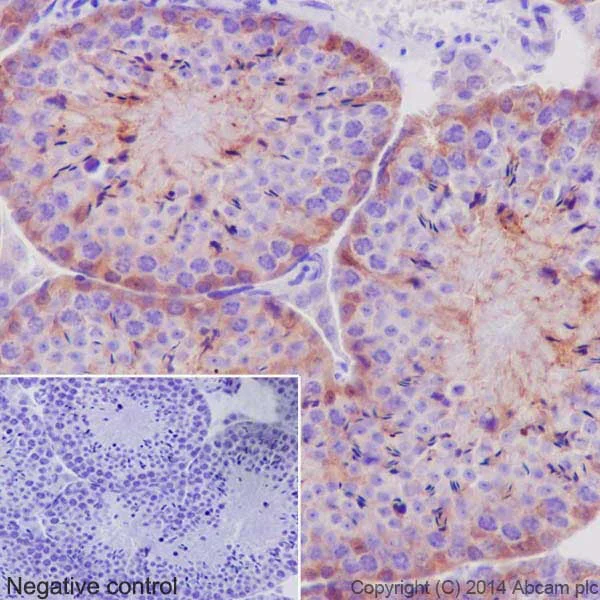 Immunohistochemistry (Formalin/PFA-fixed paraffin-embedded sections) - Anti-PKC antibody [EPR17368] - BSA and Azide free (AB250508)