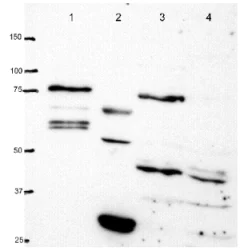 Western blot - Anti-PKC antibody [MC5] (AB31)