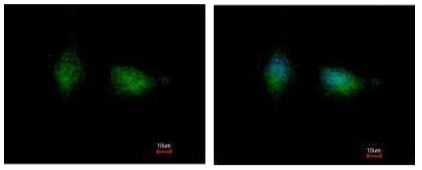 Immunocytochemistry/ Immunofluorescence - Anti-PKC beta 1 antibody (AB227490), expandable thumbnail