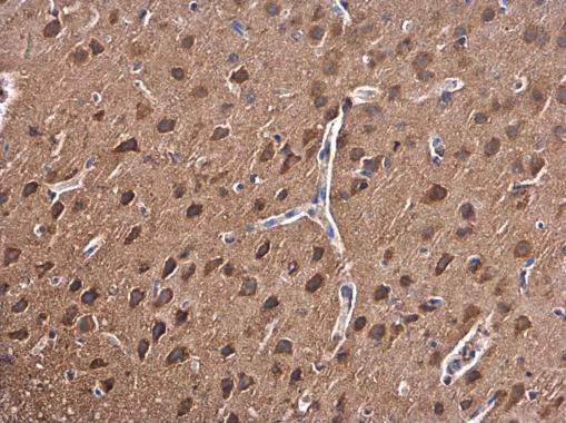 Immunohistochemistry (Formalin/PFA-fixed paraffin-embedded sections) - Anti-PKC beta 1 antibody (AB227490), expandable thumbnail