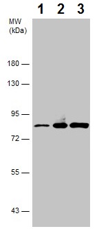 Western blot - Anti-PKC beta 1 antibody (AB227490), expandable thumbnail