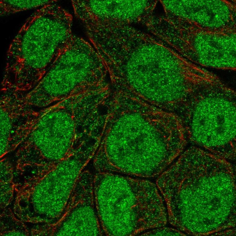 Immunocytochemistry/ Immunofluorescence - Anti-PKC beta 1 antibody (AB262849), expandable thumbnail