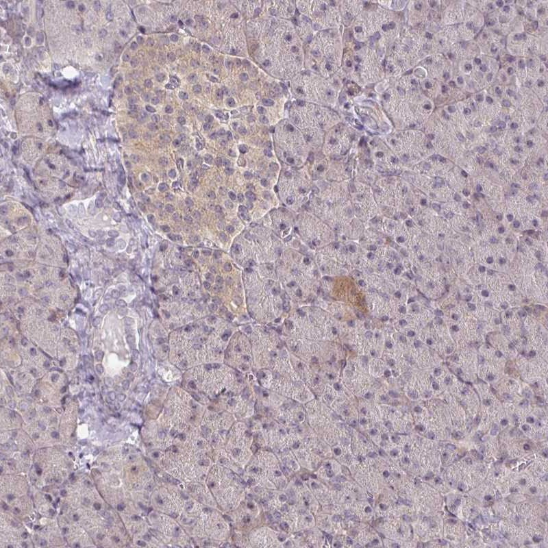 Immunohistochemistry (Formalin/PFA-fixed paraffin-embedded sections) - Anti-PKC beta 1 antibody (AB262849), expandable thumbnail