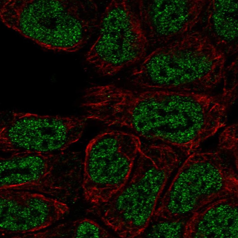Immunocytochemistry/ Immunofluorescence - Anti-PKC beta 1 antibody (AB262850), expandable thumbnail