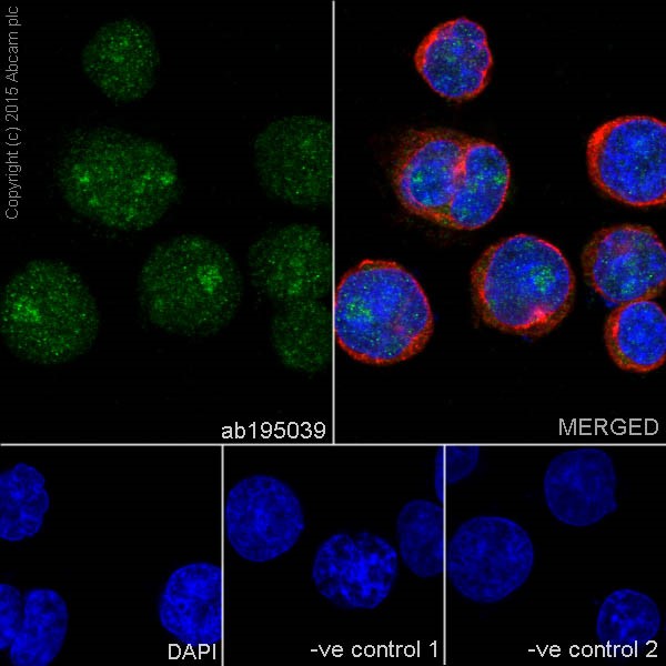 Immunocytochemistry/ Immunofluorescence - Anti-PKC beta 1 antibody [EPR18512] - BSA and Azide free (AB232518), expandable thumbnail