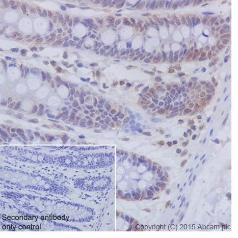 Immunohistochemistry (Formalin/PFA-fixed paraffin-embedded sections) - Anti-PKC beta 1 antibody [EPR18512] - BSA and Azide free (ab232518), expandable thumbnail