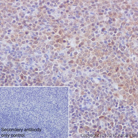 Immunohistochemistry (Formalin/PFA-fixed paraffin-embedded sections) - Anti-PKC beta 1 antibody [EPR18512] - BSA and Azide free (ab232518), expandable thumbnail