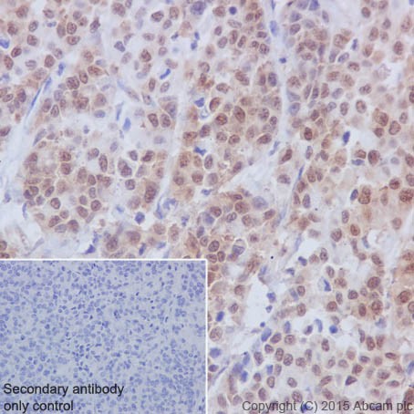 Immunohistochemistry (Formalin/PFA-fixed paraffin-embedded sections) - Anti-PKC beta 1 antibody [EPR18512] - BSA and Azide free (AB232518), expandable thumbnail