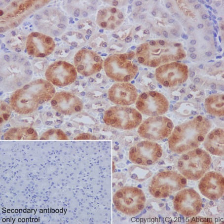 Immunohistochemistry (Formalin/PFA-fixed paraffin-embedded sections) - Anti-PKC beta 1 antibody [EPR18512] - BSA and Azide free (AB232518), expandable thumbnail