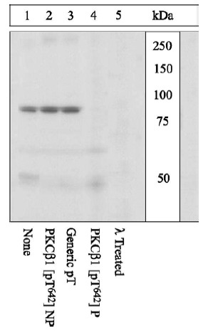 Western blot - Anti-PKC beta 1 (phospho T642) antibody (AB5782), expandable thumbnail