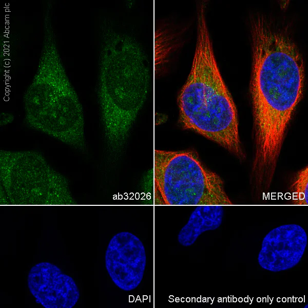 Immunocytochemistry/ Immunofluorescence - Anti-PKC beta 2 antibody [Y125] - BSA and Azide free (AB239798)