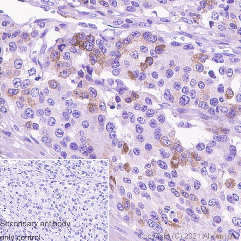 Immunohistochemistry (Formalin/PFA-fixed paraffin-embedded sections) - Anti-PKC beta 2 antibody [Y125] - BSA and Azide free (AB239798)