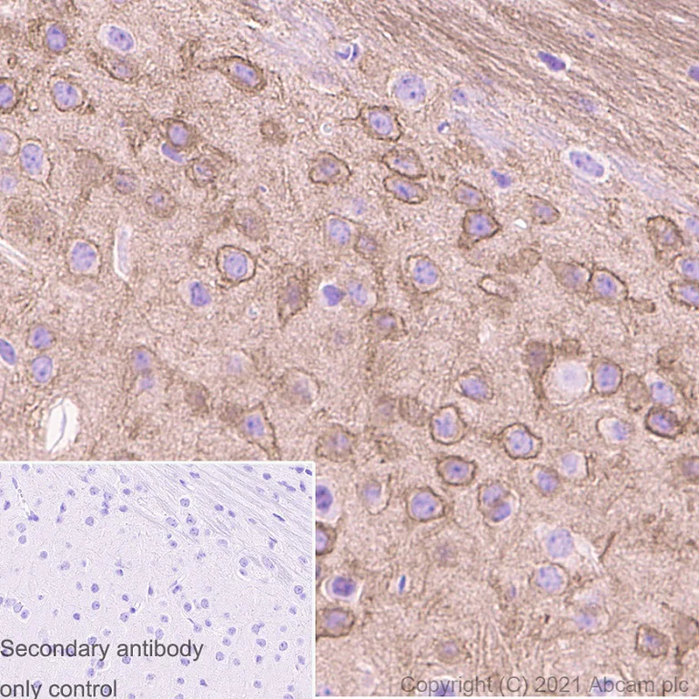Immunohistochemistry (Formalin/PFA-fixed paraffin-embedded sections) - Anti-PKC beta 2 antibody [Y125] - BSA and Azide free (AB239798)