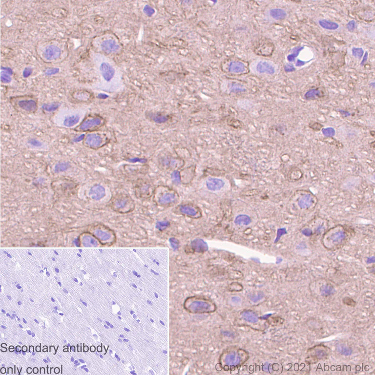 Immunohistochemistry (Formalin/PFA-fixed paraffin-embedded sections) - Anti-PKC beta 2 antibody [Y125] - BSA and Azide free (AB239798)