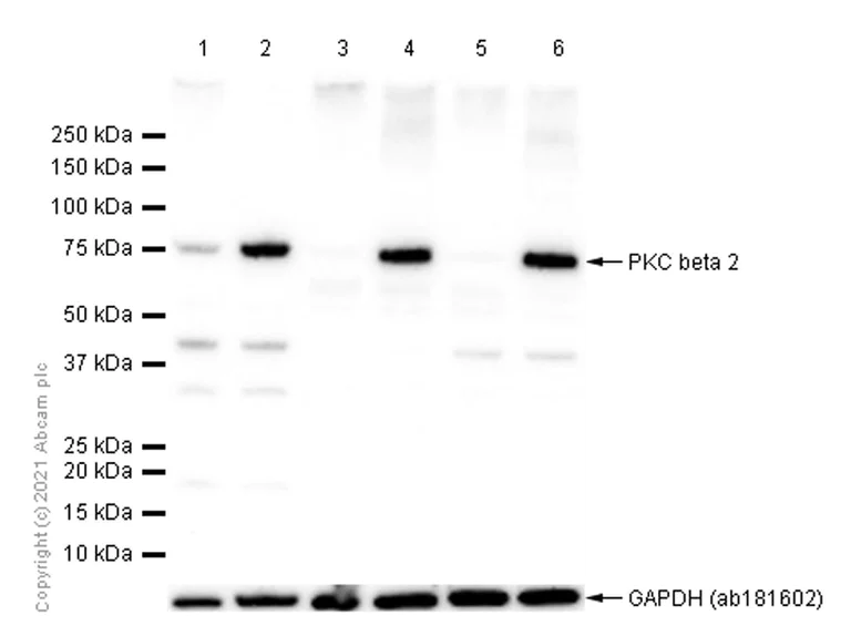 Western blot - Anti-PKC beta 2 antibody [Y125] - BSA and Azide free (AB239798)