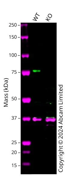 Western blot - Anti-PKC delta antibody [14/PKC delta] (AB307233)