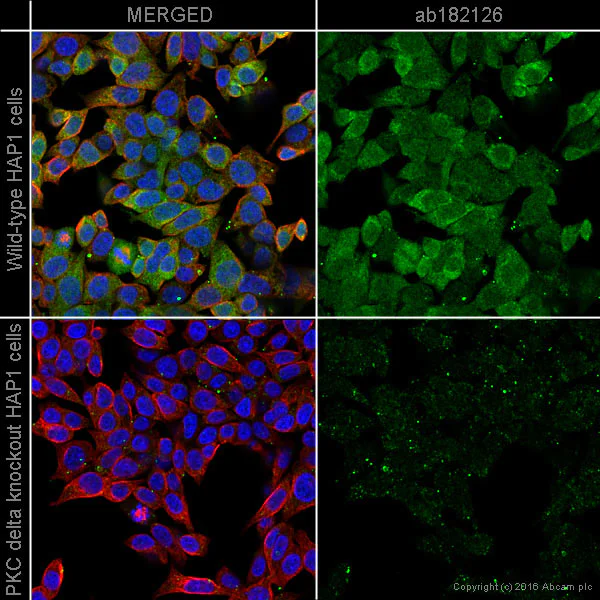 Immunocytochemistry/ Immunofluorescence - Anti-PKC delta antibody [EPR17075] (AB182126)