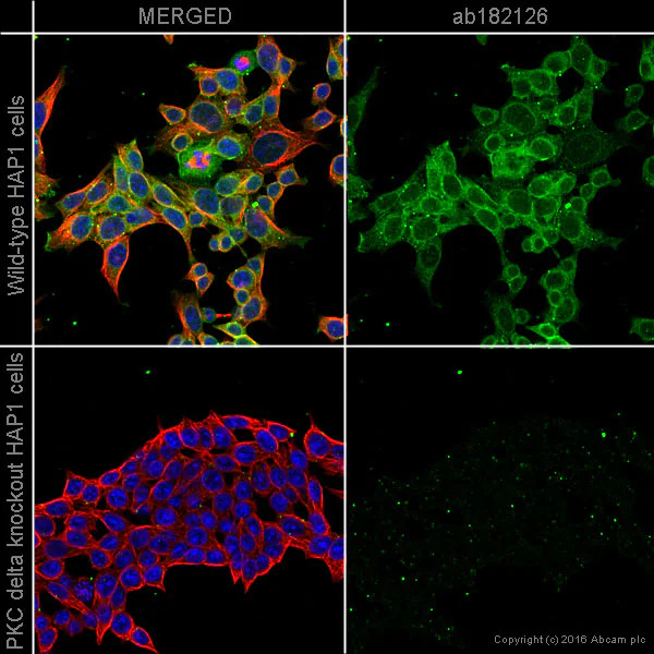 Immunocytochemistry/ Immunofluorescence - Anti-PKC delta antibody [EPR17075] (AB182126)