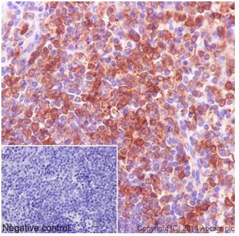 Immunohistochemistry (Formalin/PFA-fixed paraffin-embedded sections) - Anti-PKC delta antibody [EPR17075] (AB182126)