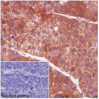 Immunohistochemistry (Formalin/PFA-fixed paraffin-embedded sections) - Anti-PKC delta antibody [EPR17075] (AB182126)