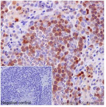 Immunohistochemistry (Formalin/PFA-fixed paraffin-embedded sections) - Anti-PKC delta antibody [EPR17075] - BSA and Azide free (AB222229)