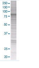 PKC delta overexpression 293T lysate (whole cell)