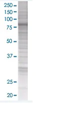 SDS-PAGE - PKC delta overexpression 293T lysate (whole cell) (AB94099)