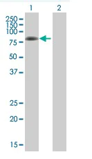 Western blot - PKC delta overexpression 293T lysate (whole cell) (AB94099)