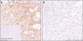 Immunohistochemistry (Formalin/PFA-fixed paraffin-embedded sections) - Anti-PKC delta (phospho S299) antibody [EPNCI119] (AB133456)