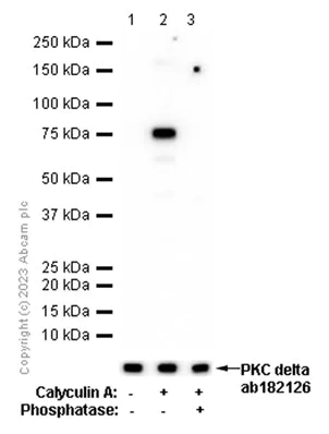 Western blot - Anti-PKC delta (phospho S299) antibody [EPNCI119] - BSA and Azide free (AB188170)