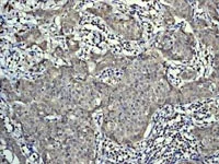 Immunohistochemistry (Formalin/PFA-fixed paraffin-embedded sections) - Anti-PKC delta (phospho S645) antibody [EP1486Y] (AB108972)