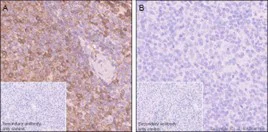 Immunohistochemistry (Formalin/PFA-fixed paraffin-embedded sections) - Anti-PKC delta (phospho S645) antibody [EP1486Y] (AB108972)