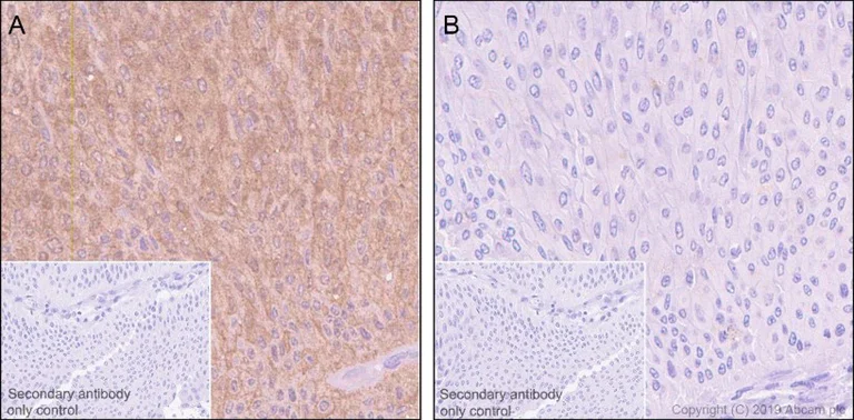 Immunohistochemistry (Formalin/PFA-fixed paraffin-embedded sections) - Anti-PKC delta (phospho S645) antibody [EP1486Y] (AB108972)