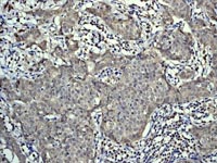 Immunohistochemistry (Formalin/PFA-fixed paraffin-embedded sections) - Anti-PKC delta (phospho S645) antibody [EP1486Y] - BSA and Azide free (ab284781), expandable thumbnail