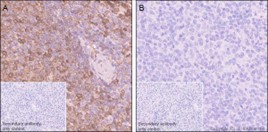 Immunohistochemistry (Formalin/PFA-fixed paraffin-embedded sections) - Anti-PKC delta (phospho S645) antibody [EP1486Y] - BSA and Azide free (ab284781), expandable thumbnail