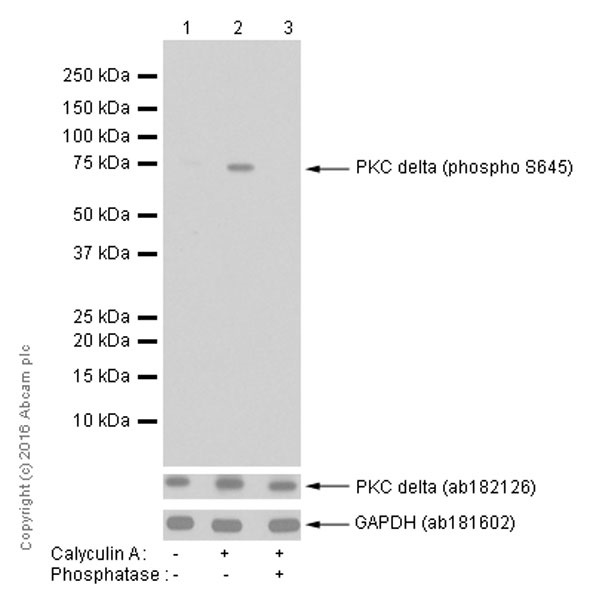 Western blot - Anti-PKC delta (phospho S645) antibody [EP1486Y] - BSA and Azide free (AB284781), expandable thumbnail