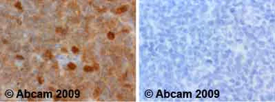 Immunohistochemistry (Formalin/PFA-fixed paraffin-embedded sections) - Anti-PKC delta (phospho T505) antibody (AB60992)