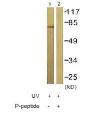 Western blot - Anti-PKC delta (phospho T505) antibody (AB60992)