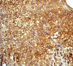 Immunohistochemistry (Formalin/PFA-fixed paraffin-embedded sections) - Anti-PKC delta (phospho Y311) antibody [EPR2609Y] (AB76181)