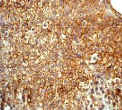 Immunohistochemistry (Formalin/PFA-fixed paraffin-embedded sections) - Anti-PKC delta (phospho Y311) antibody [EPR2609Y] - BSA and Azide free (AB247449), expandable thumbnail