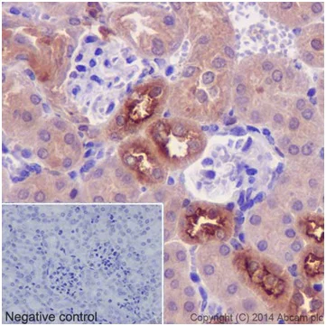 Immunohistochemistry (Formalin/PFA-fixed paraffin-embedded sections) - Anti-PKC delta + PKC theta antibody [EPR17074] (AB182127)