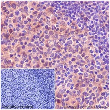 Immunohistochemistry (Formalin/PFA-fixed paraffin-embedded sections) - Anti-PKC delta + PKC theta antibody [EPR17074] (AB182127)