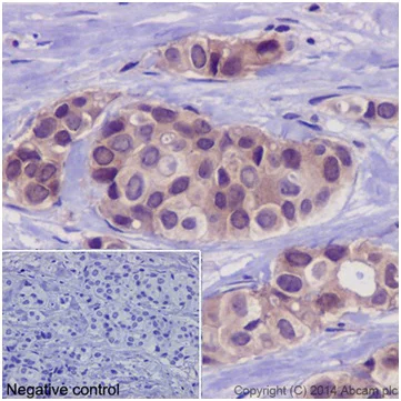 Immunohistochemistry (Formalin/PFA-fixed paraffin-embedded sections) - Anti-PKC delta + PKC theta antibody [EPR17074] (AB182127)