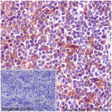 Immunohistochemistry (Formalin/PFA-fixed paraffin-embedded sections) - Anti-PKC delta + PKC theta antibody [EPR17074] (AB182127)