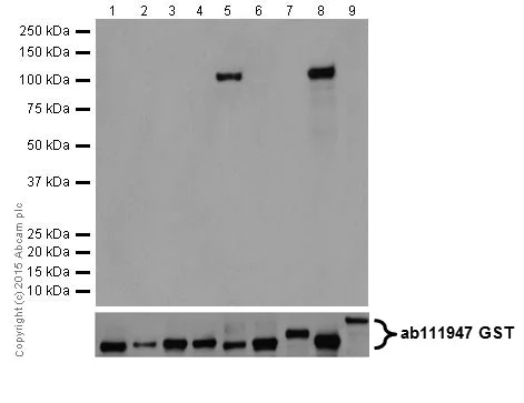 Western blot - Anti-PKC delta + PKC theta antibody [EPR17074] (AB182127)