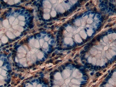Immunohistochemistry (Formalin/PFA-fixed paraffin-embedded sections) - Anti-PKC epsilon antibody (AB233292), expandable thumbnail