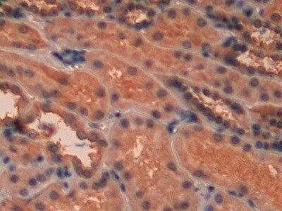 Immunohistochemistry (Formalin/PFA-fixed paraffin-embedded sections) - Anti-PKC epsilon antibody (AB233292), expandable thumbnail